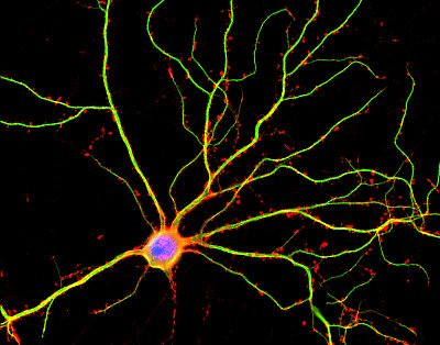 促进海马体中神经元的生成或能缓解阿尔茨海默症